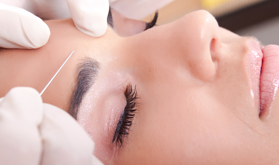 Botulinum Toxin (Botox)